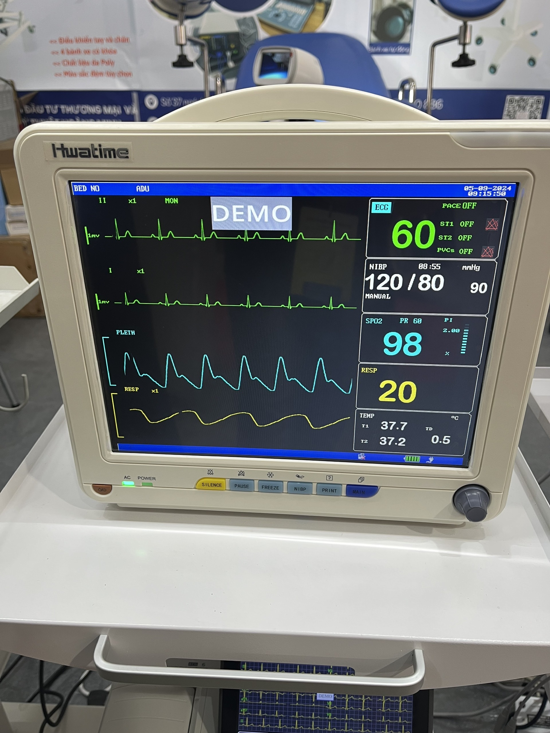 moniter moniter theo dõi bệnh nhân