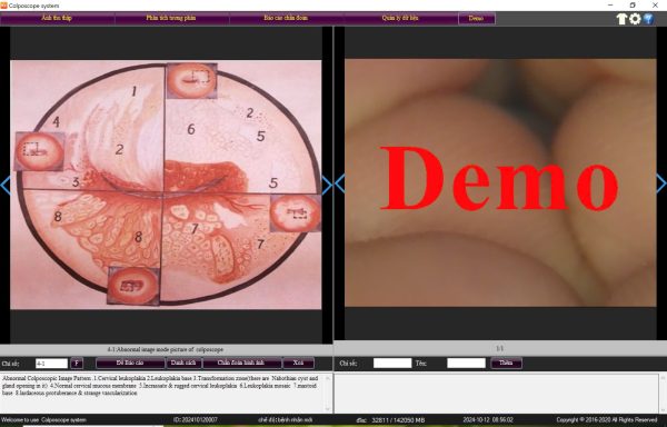 Phần mềm máy soi cổ tử cung Kernel KN 2200